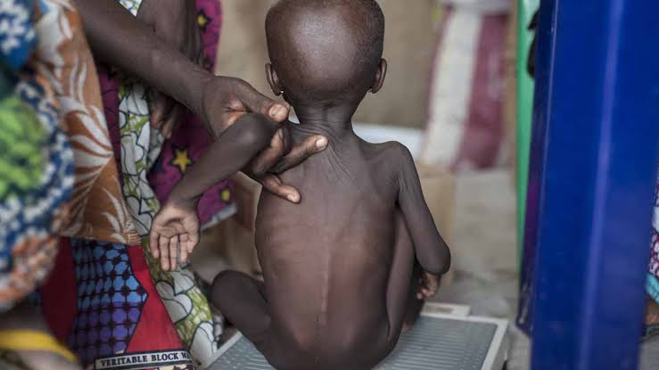 Thousands of children at risk as malnutrition deepens in Borno